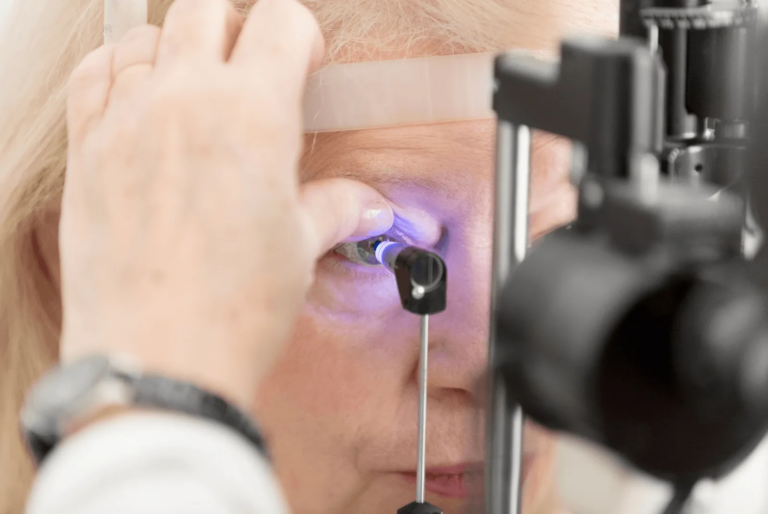 Glaucoma
