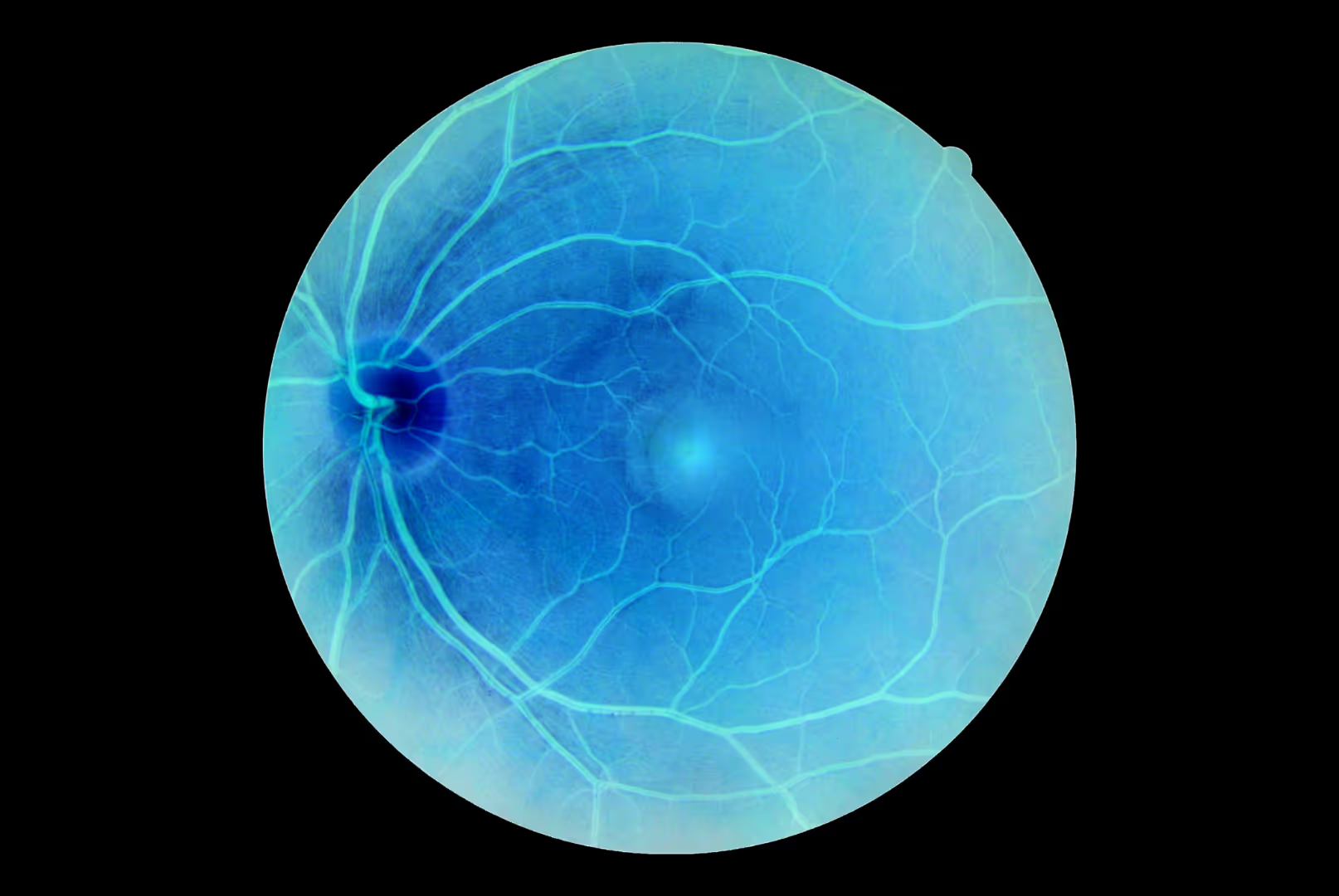 Retina Médica